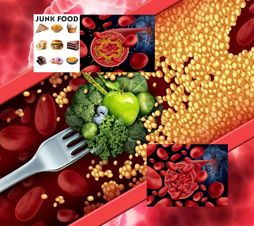 Cholesterol and Weight Management With Greater Food Freedom; How Established, Long-Standing Scientific Data Indicates That Fiber Can Counteract the Effects of a Less-Than-Perfect Diet